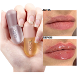 Derol Up Lips [PAGUE 1 E LEVE 2]